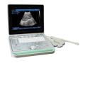 Ultrasound de machine à ultrasons basée sur PC SS-9